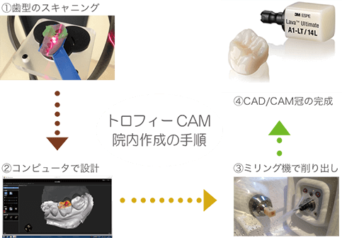 CAD/CAM冠の制作の流れ